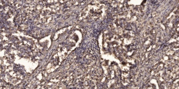 LAT antibody