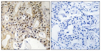 LATS1/2 antibody