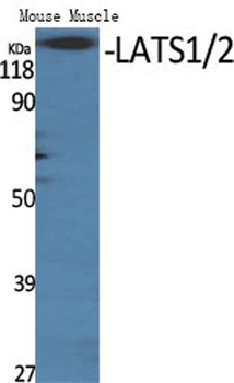 LATS1/2 antibody