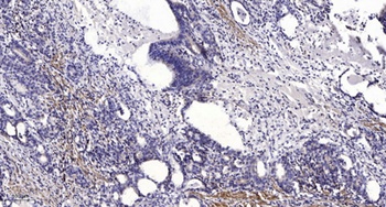 LDLRAD1 rabbit pAb Antibody