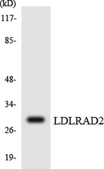 LDLRAD2 rabbit pAb