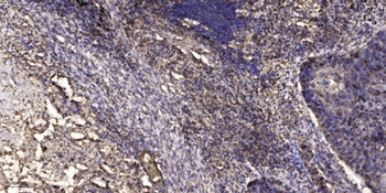 LDLRAD2 antibody