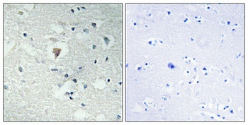 LDOC1L antibody