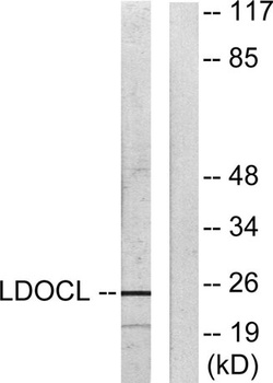 LDOC1L rabbit pAb
