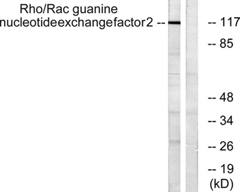 Lfc antibody