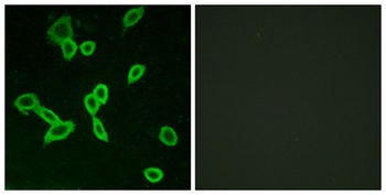 LGR6 antibody