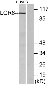 LGR6 antibody