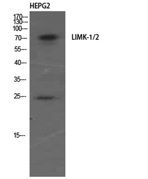 LIMK-1/2 rabbit pAb