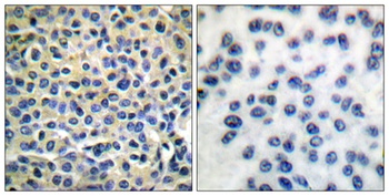 LIMK-1/2 antibody