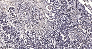 Liprin β1 rabbit pAb
