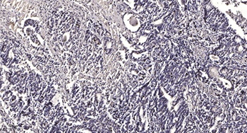 Liprin beta 1 antibody