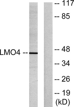 LMO4 rabbit pAb