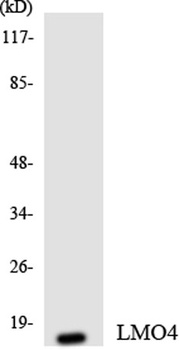 LMO4 antibody