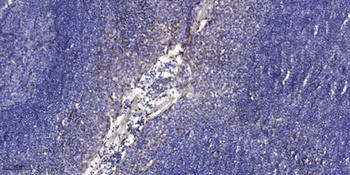 LMO4 antibody