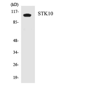 LOK antibody