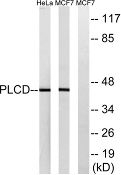 LPAAT-delta antibody