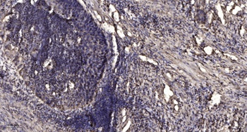 LPAAT-delta antibody