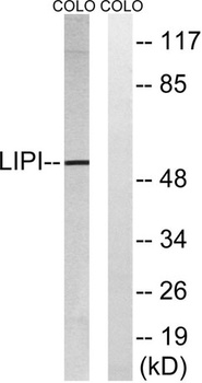LPD lipase rabbit pAb
