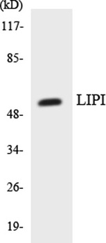 LPD lipase antibody