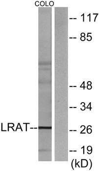 LRAT antibody