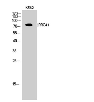 LRRC41 antibody