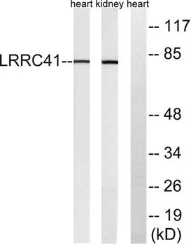LRRC41 rabbit pAb