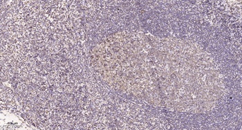 LRRC41 rabbit pAb