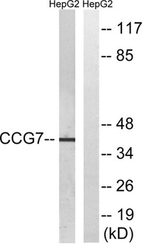 L-type Ca++ CP γ7 rabbit pAb
