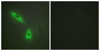 LT-β rabbit pAb