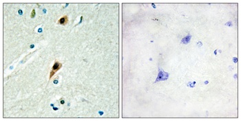 LUCA15 antibody