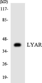 LYAR antibody