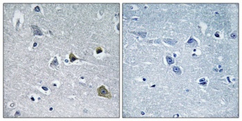LYPLA1 rabbit pAb