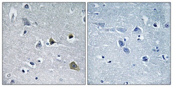 LYPLA1 antibody