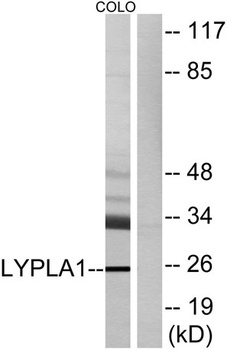 LYPLA1 rabbit pAb