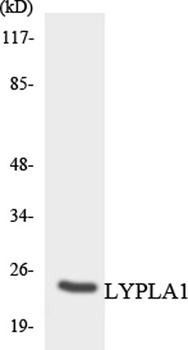 LYPLA1 antibody