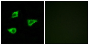 mAChR M4 antibody