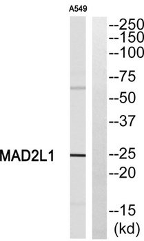 MAD2 antibody