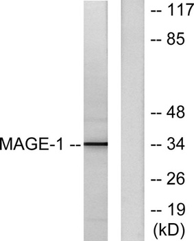 MAGE-1 rabbit pAb
