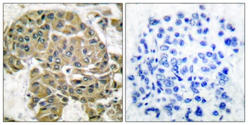 Mammaglobin B antibody