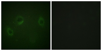 MARK1/2/3/4 antibody