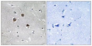 MARK1/2/3/4 antibody