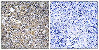 MAST205 antibody