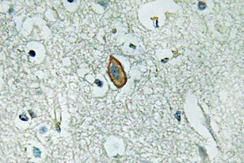 MaxiKα rabbit pAb