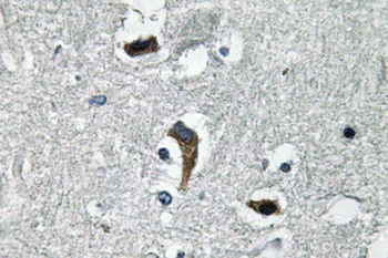 MaxiKβ rabbit pAb