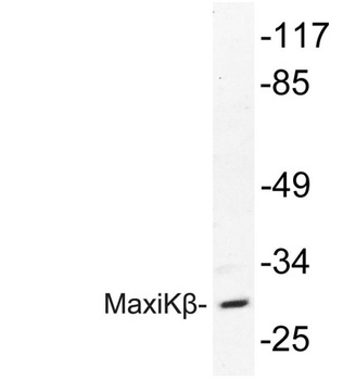 MaxiK beta antibody