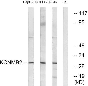 MaxiKβ2 rabbit pAb