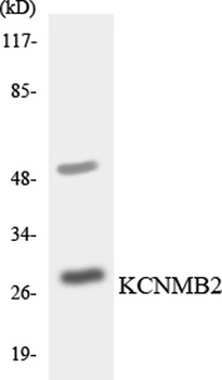 MaxiKβ2 rabbit pAb