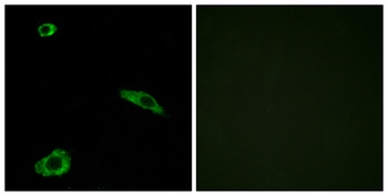 MC2-R antibody