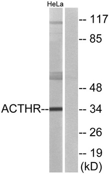 MC2-R rabbit pAb