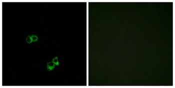 MC5-R antibody